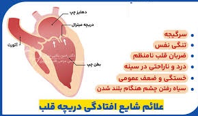 تشخیص و درمان افتادگی دریچه میترال